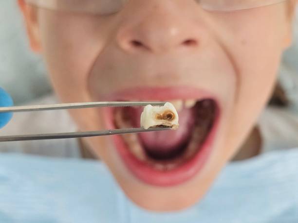 Best Cosmetic Emergency Dentistry in Baltimore Highlands, MD